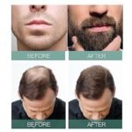 iKGJS4c0d17626e674b5cbf7bf8169b0a6e9fc