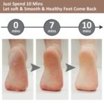 electric foot pedicure machine 574472.jpg