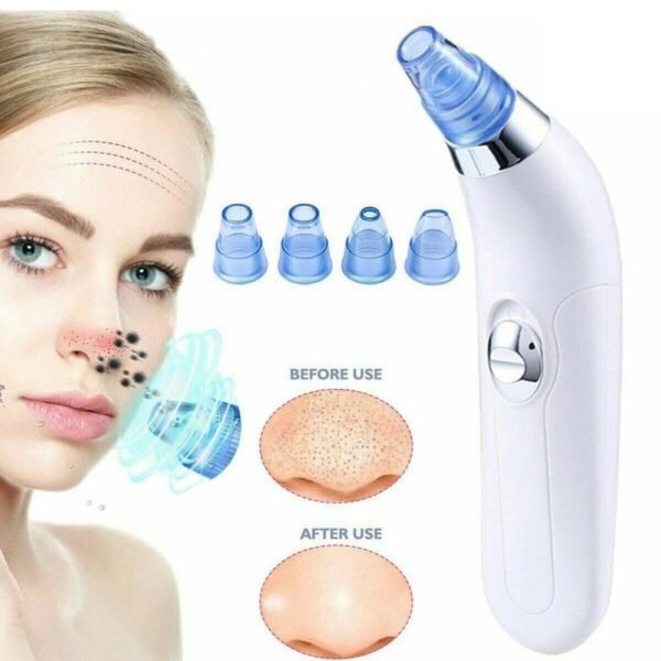 DermaSuctionPoreCleaningDeviceBlackheadRemover AcnePimplePoreCleanerVacuumSuctionToolForMenAndWomen3.jpg